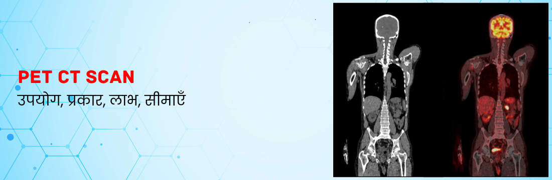 PET CT Scan: उपयोग, प्रकार, लाभ, सीमाएँ